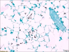 Sodium Thiosulfate Solution 2 g/dL in deionized water