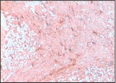 Anti-Glial Fibrillary Acidic Protein antibody produced in rabbit IgG fraction of antiserum, buffered aqueous solution