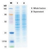 cOmplete™ Lysis-M Individually packed in foil blister packs