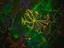 Anti-Glial Fibrillary Acidic Protein Antibody Chemicon®, from chicken