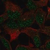 Anti-ZNF677 antibody produced in rabbit Prestige Antibodies® Powered by Atlas Antibodies, affinity isolated antibody, buffered aqueous glycerol solution, Ab1