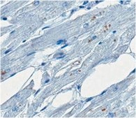 Anti-GD1a Ganglioside Antibody, clone GD1a-1 (Azide Free) clone GD1a-1, from mouse