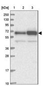 Anti-ATE1 antibody produced in rabbit Prestige Antibodies® Powered by Atlas Antibodies, affinity isolated antibody, buffered aqueous glycerol solution