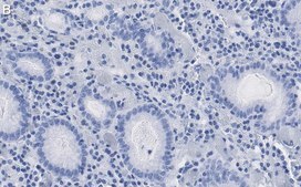 Anti-p-CREB (Ser133) Antibody, clone 1H13 ZooMAb® Rabbit Monoclonal recombinant, expressed in HEK 293 cells