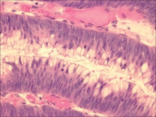 Mayer′s Hematoxylin Solution