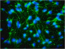 Anti-Nestin Antibody, clone rat-401, Alexa Fluor™ 488 conjugate clone rat-401, from mouse, ALEXA FLUOR™ 488
