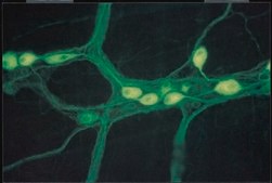 Anti-Neurofilament M (145 kDa) Antibody, CT serum, Chemicon®