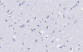 Anti-LC3A Antibody, clone 3J12 ZooMAb® Rabbit Monoclonal recombinant, expressed in HEK 293 cells