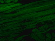 抗ミオシン（骨格、速筋型）抗体、マウスモノクロナール clone MY-32, purified from hybridoma cell culture