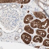 Anti-KHK antibody produced in rabbit Prestige Antibodies® Powered by Atlas Antibodies, affinity isolated antibody, buffered aqueous glycerol solution