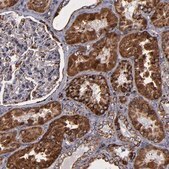 抗SOD2抗体 ウサギ宿主抗体 Prestige Antibodies® Powered by Atlas Antibodies, affinity isolated antibody, buffered aqueous glycerol solution