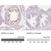 Anti-ROPN1L antibody produced in rabbit affinity isolated antibody, buffered aqueous glycerol solution