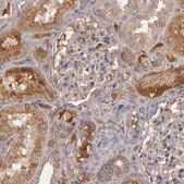 Anti-CFB antibody produced in rabbit Ab3, Prestige Antibodies® Powered by Atlas Antibodies, affinity isolated antibody, buffered aqueous glycerol solution