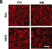 Anti-Tubulin β III Antibody Chemicon®, from mouse
