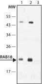 Anti-Rab18 antibody produced in rabbit ~1.0 mg/mL, affinity isolated antibody