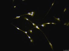 CNS-1 Rat Glioma Cell Line
