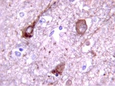 Anti-Tau phospho Threonine 231 Antibody Chemicon®, from rabbit