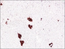モノクロナール抗インスリン マウス宿主抗体 clone K36AC10, ascites fluid
