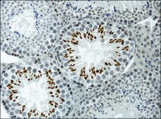 Anti-acetyl-Histone H3 (Ac-Lys9) antibody produced in rabbit 2-2.5 mg/mL, affinity isolated antibody, buffered aqueous solution