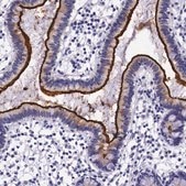 Anti-ACE2 antibody produced in rabbit Prestige Antibodies® Powered by Atlas Antibodies, affinity isolated antibody, buffered aqueous glycerol solution