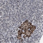 Anti-USP16 antibody produced in rabbit Prestige Antibodies® Powered by Atlas Antibodies, affinity isolated antibody, buffered aqueous glycerol solution