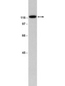 Anti-FAK Antibody, clone 4.47 clone 4.47, Upstate®, from mouse