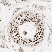 ANTI-MDC1 antibody produced in rabbit Prestige Antibodies® Powered by Atlas Antibodies, affinity isolated antibody, buffered aqueous glycerol solution