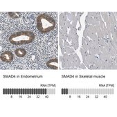 Anti-SMAD4 antibody produced in rabbit Prestige Antibodies® Powered by Atlas Antibodies, affinity isolated antibody, buffered aqueous glycerol solution