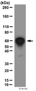 Anti-NFκB p65 Antibody, CT from rabbit