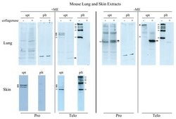 Anti-Pro-Collagen Type I, A1/COL1A1 from rabbit, purified by affinity chromatography