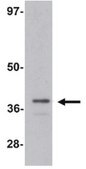 Anti-ZIP-1 Antibody from rabbit, purified by affinity chromatography