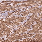 Anti-TBC1D2B antibody produced in rabbit Prestige Antibodies® Powered by Atlas Antibodies, affinity isolated antibody, buffered aqueous glycerol solution