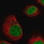 Anti-DCPS antibody produced in rabbit Prestige Antibodies® Powered by Atlas Antibodies, affinity isolated antibody, buffered aqueous glycerol solution