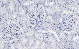Anti-ZO-1 Antibody, clone 4E14 ZooMAb® Rabbit Monoclonal recombinant, expressed in HEK 293 cells