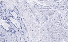 Anti-Vinculin Antibody, clone 3M13 ZooMAb® Rabbit Monoclonal recombinant, expressed in HEK 293 cells