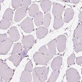 Anti-RMDN3 antibody produced in rabbit Prestige Antibodies® Powered by Atlas Antibodies, affinity isolated antibody, buffered aqueous glycerol solution