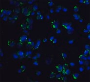 Anti-STIM1 antibody produced in rabbit affinity isolated antibody, buffered aqueous solution