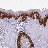 Anti-KRT5 antibody produced in rabbit Prestige Antibodies® Powered by Atlas Antibodies, affinity isolated antibody, buffered aqueous glycerol solution
