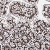 Anti-TOP2B antibody produced in rabbit Prestige Antibodies® Powered by Atlas Antibodies, affinity isolated antibody, buffered aqueous glycerol solution