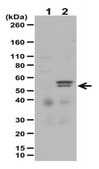 Anti-phospho-MLKL (Ser358) Antibody Set from rabbit, purified by affinity chromatography