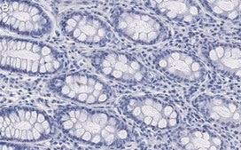 Anti-Na+-K+ ATPase α1 Antibody, clone 1E13 ZooMAb® Rabbit Monoclonal recombinant, expressed in HEK 293 cells