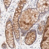 Anti-NPNT antibody produced in rabbit Prestige Antibodies® Powered by Atlas Antibodies, affinity isolated antibody, buffered aqueous glycerol solution