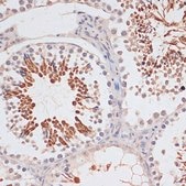 Anti-CDKN2A/p16INK4a antibody produced in rabbit