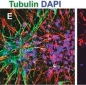 Anti-Tubulin Antibody, beta III isoform, CT, clone TU-20 (Similar to TUJ1) ascites fluid, clone TU-20 (Similar to TUJ1), Chemicon®
