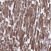 Anti-TTN antibody produced in rabbit Prestige Antibodies® Powered by Atlas Antibodies, affinity isolated antibody, buffered aqueous glycerol solution