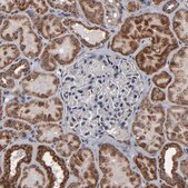 Anti-BNIP3 antibody produced in rabbit Prestige Antibodies® Powered by Atlas Antibodies, affinity isolated antibody, buffered aqueous glycerol solution