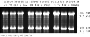 RNAlater® Stabilize and protect RNA with immediate RNase inactivation