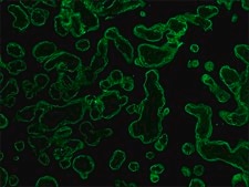 Monoclonal Anti-Cytokeratin, pan antibody produced in mouse clone PCK-26, ascites fluid