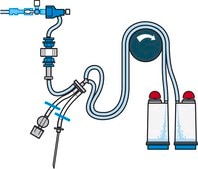 Steritest&#174; NEO Device For medical devices and collapsible bags., Blue base canister provided with 3 adaptors for connecting various test devices.
