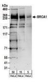 Rabbit anti-BRCA1 Antibody, Affinity Purified Powered by Bethyl Laboratories, Inc.